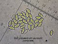 Botryobasidium aureum-amf1943-micro